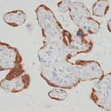 Immunohistochemistry - Anti-SARS2 Antibody (A90278) - Antibodies.com