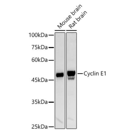 Western Blot - Anti-Cyclin E1 Antibody (A90279) - Antibodies.com