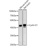 Western Blot - Anti-Cyclin E1 Antibody (A90279) - Antibodies.com