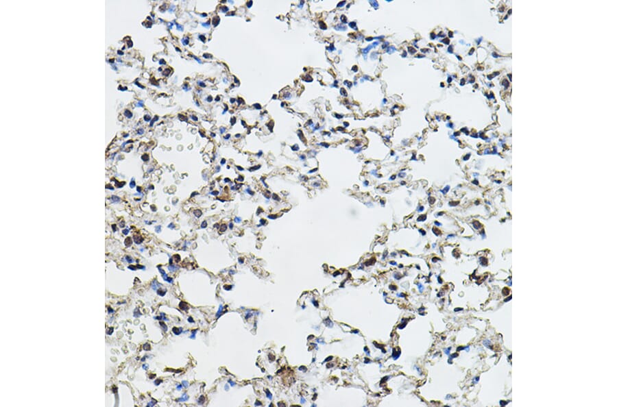 Immunohistochemistry - Anti-Cyclin E1 Antibody (A90279) - Antibodies.com