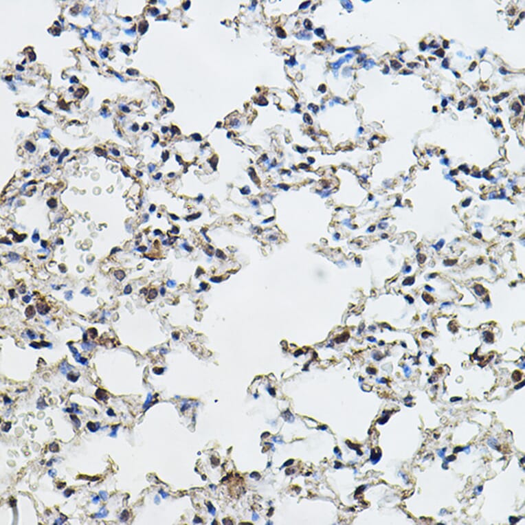 Immunohistochemistry - Anti-Cyclin E1 Antibody (A90279) - Antibodies.com