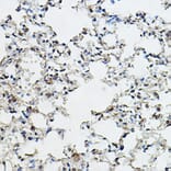 Immunohistochemistry - Anti-Cyclin E1 Antibody (A90279) - Antibodies.com