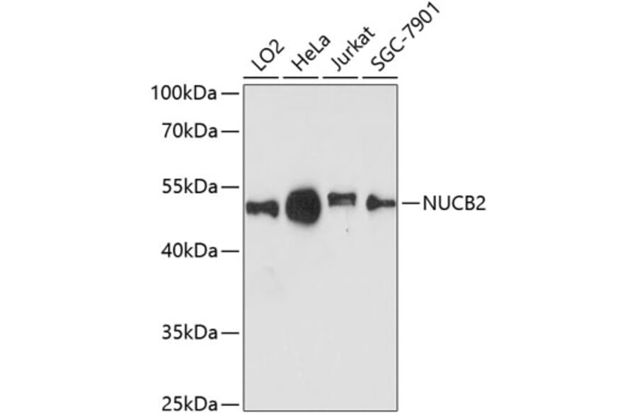 Western Blot - Anti-NUCB2 Antibody (A90280) - Antibodies.com