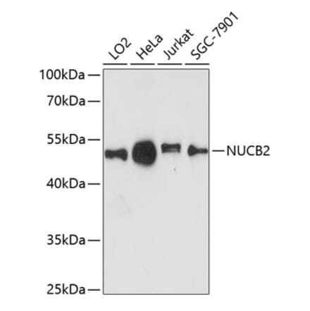 Western Blot - Anti-NUCB2 Antibody (A90280) - Antibodies.com