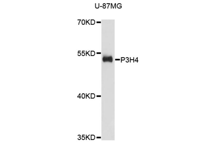 Western Blot - Anti-P3H4 Antibody (A13754) - Antibodies.com