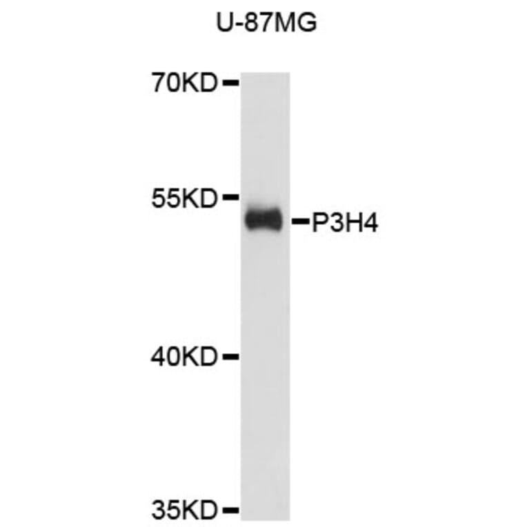 Western Blot - Anti-P3H4 Antibody (A13754) - Antibodies.com