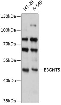 Western blot analysis of extracts of various cell lines, using Anti-B3GNT5 Antibody (A14428) at 1:3000 dilution.
Secondary antibody: Goat Anti-Rabbit IgG (H+L) (HRP) (AS014) at 1:10,000 dilution.
Lysates / proteins: 25µg per lane.
Blocking buffer: 3% non-fat dry milk in TBST.
Detection: ECL Basic Kit (RM00020).
Exposure time: 30s.