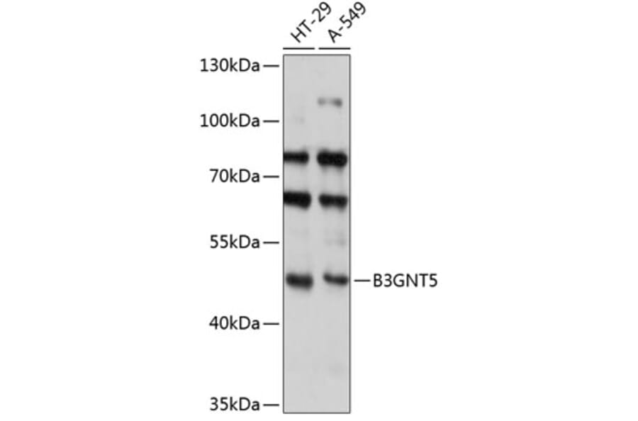 Western Blot - Anti-B3GNT5 Antibody (A90283) - Antibodies.com