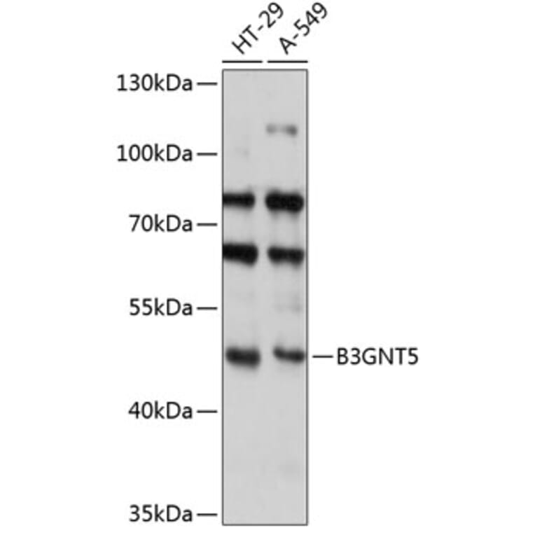 Western Blot - Anti-B3GNT5 Antibody (A90283) - Antibodies.com