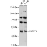 Western Blot - Anti-B3GNT5 Antibody (A90283) - Antibodies.com