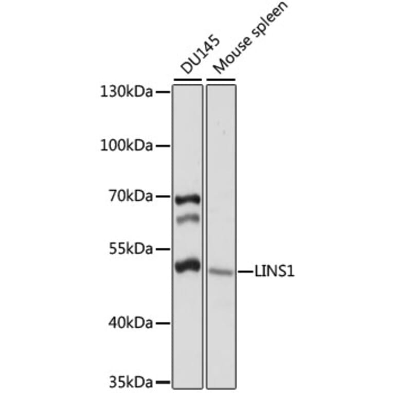 Western Blot - Anti-LINS1 Antibody (A90286) - Antibodies.com