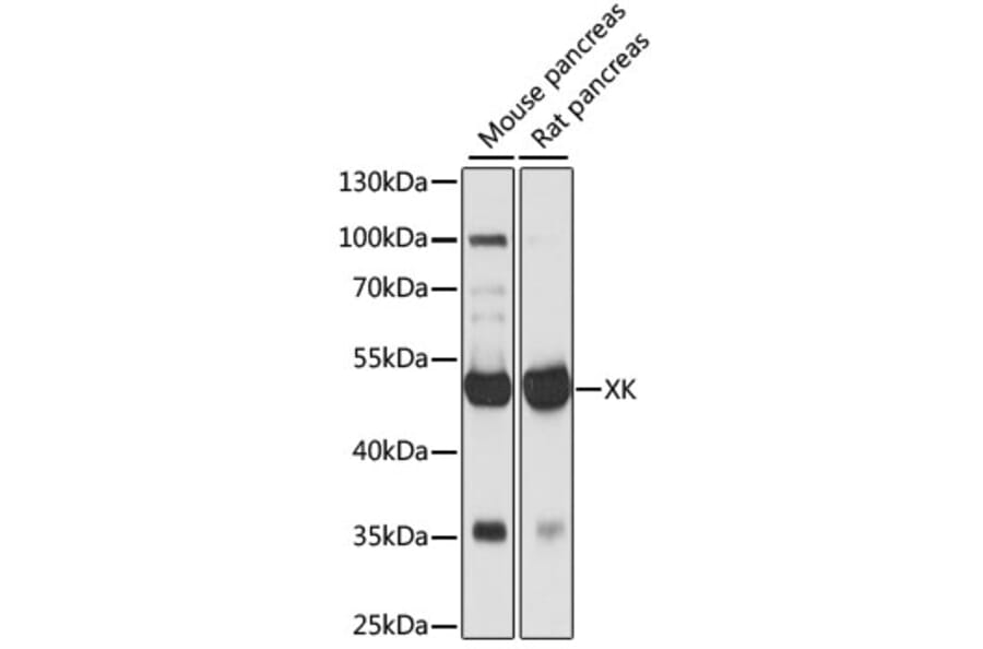 Western Blot - Anti-XK Antibody (A90287) - Antibodies.com