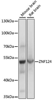 Western blot analysis of extracts of various cell lines, using Anti-ZNF124 Antibody (A15111) at 1:1,000 dilution.
Secondary antibody: Goat Anti-Rabbit IgG (H+L) (HRP) (AS014) at 1:10,000 dilution.
Lysates / proteins: 25µg per lane.
Blocking buffer: 3% non-fat dry milk in TBST.
Detection: ECL Basic Kit (RM00020).
Exposure time: 1s.