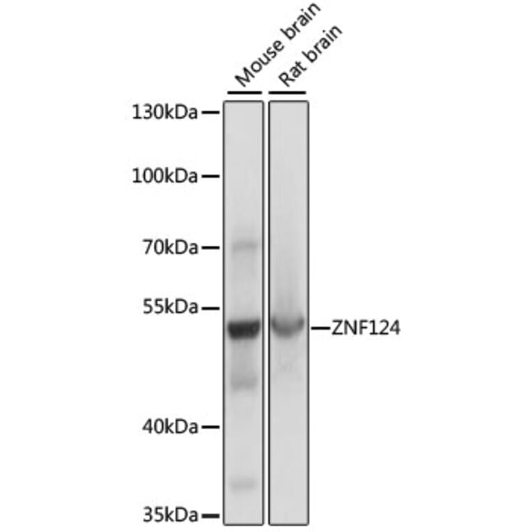 Western Blot - Anti-ZNF124 Antibody (A90288) - Antibodies.com