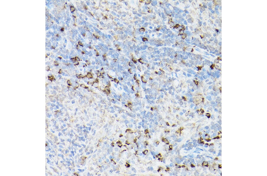 Immunohistochemistry - Anti-Fas Antibody (A90289) - Antibodies.com