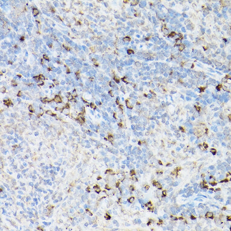 Immunohistochemistry - Anti-Fas Antibody (A90289) - Antibodies.com