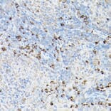 Immunohistochemistry - Anti-Fas Antibody (A90289) - Antibodies.com