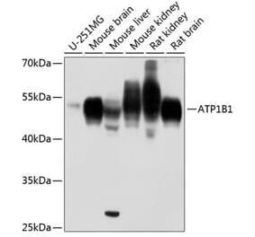 Western Blot - Anti-ATP1B1 Antibody (A90290) - Antibodies.com