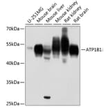 Western Blot - Anti-ATP1B1 Antibody (A90290) - Antibodies.com