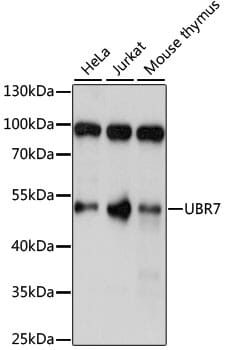 Western blot analysis of extracts of various cell lines, using Anti-UBR7 Antibody (A15464) at 1:1,000 dilution.
Secondary antibody: Goat Anti-Rabbit IgG (H+L) (HRP) (AS014) at 1:10,000 dilution.
Lysates / proteins: 25µg per lane.
Blocking buffer: 3% non-fat dry milk in TBST.
Detection: ECL Basic Kit (RM00020).
Exposure time: 5s.