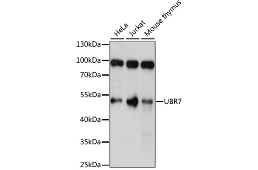 Western Blot - Anti-UBR7 Antibody (A90291) - Antibodies.com