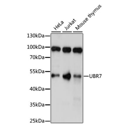 Western Blot - Anti-UBR7 Antibody (A90291) - Antibodies.com