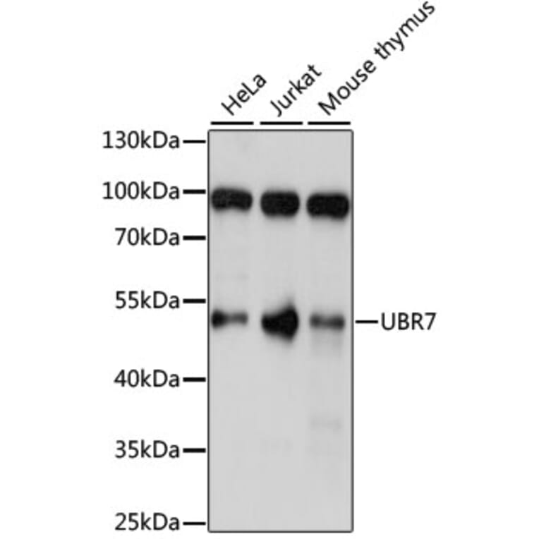 Western Blot - Anti-UBR7 Antibody (A90291) - Antibodies.com