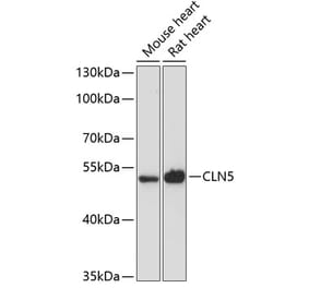 Western Blot - Anti-CLN5 Antibody (A90292) - Antibodies.com