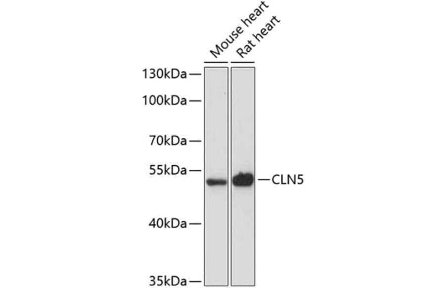 Western Blot - Anti-CLN5 Antibody (A90292) - Antibodies.com