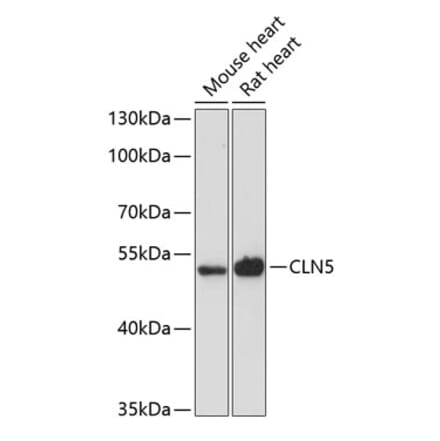 Western Blot - Anti-CLN5 Antibody (A90292) - Antibodies.com