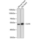 Western Blot - Anti-CLN5 Antibody (A90292) - Antibodies.com