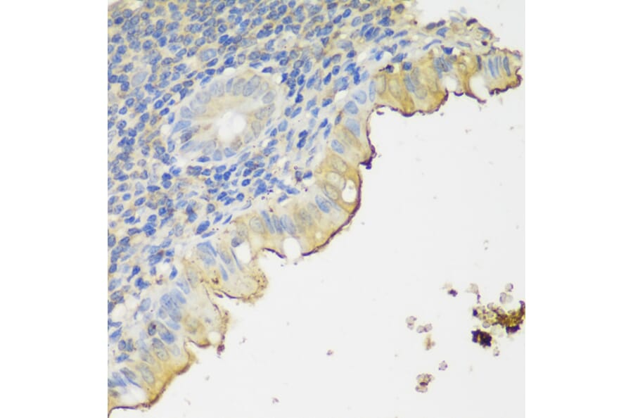 Immunohistochemistry - Anti-CLN5 Antibody (A90292) - Antibodies.com