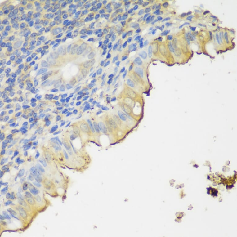 Immunohistochemistry - Anti-CLN5 Antibody (A90292) - Antibodies.com