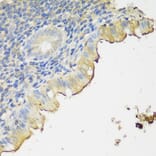 Immunohistochemistry - Anti-CLN5 Antibody (A90292) - Antibodies.com