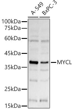 Western blot analysis of extracts of various cell lines, using Anti-MYCL Antibody (A16301) at 1:1,000 dilution.
Secondary antibody: Goat Anti-Rabbit IgG (H+L) (HRP) (AS014) at 1:10,000 dilution.
Lysates / proteins: 25µg per lane.
Blocking buffer: 3% non-fat dry milk in TBST.
Detection: ECL Basic Kit (RM00020).
Exposure time: 15s.