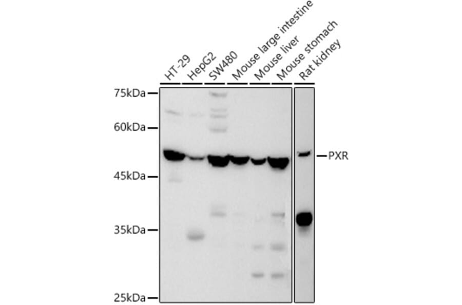 Western Blot - Anti-PXR Antibody (A90294) - Antibodies.com