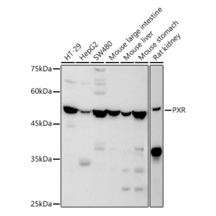 Western Blot - Anti-PXR Antibody (A90294) - Antibodies.com