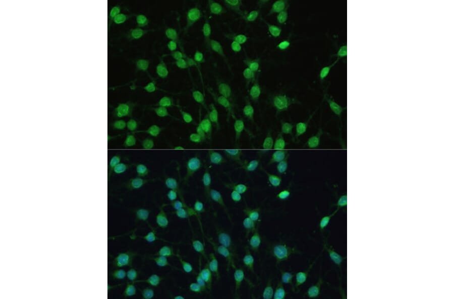 Immunofluorescence - Anti-PXR Antibody (A90294) - Antibodies.com