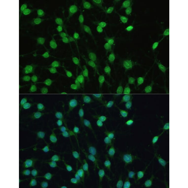 Immunofluorescence - Anti-PXR Antibody (A90294) - Antibodies.com