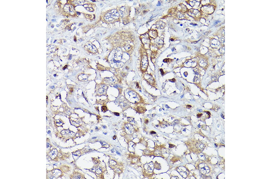 Immunohistochemistry - Anti-MLKL Antibody (A90295) - Antibodies.com