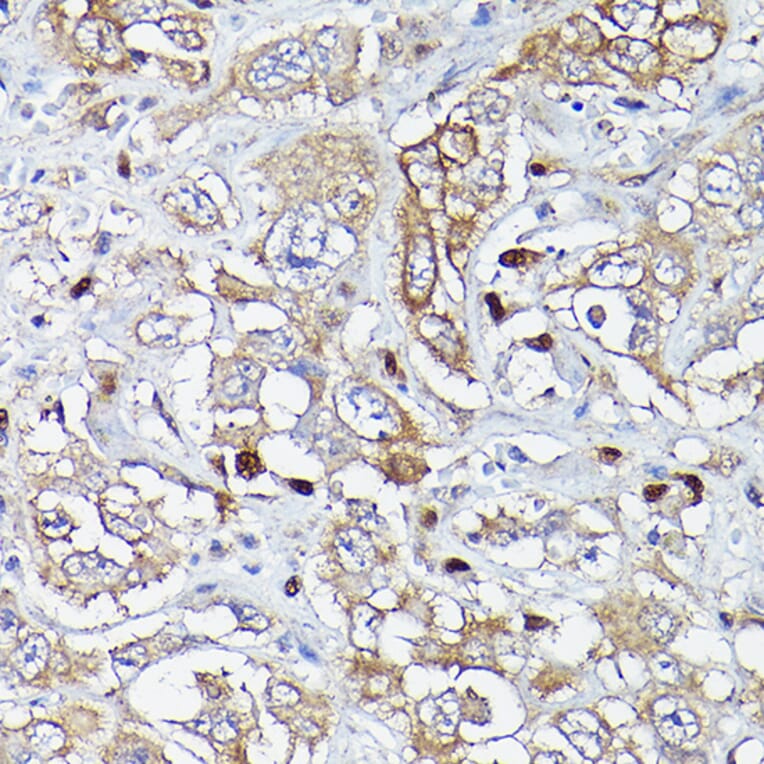 Immunohistochemistry - Anti-MLKL Antibody (A90295) - Antibodies.com