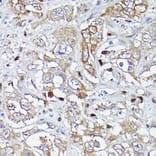 Immunohistochemistry - Anti-MLKL Antibody (A90295) - Antibodies.com