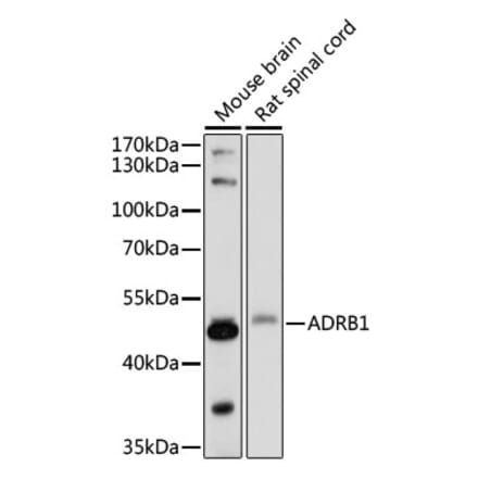 Western Blot - Anti-beta 1 Adrenergic Receptor Antibody (A90297) - Antibodies.com