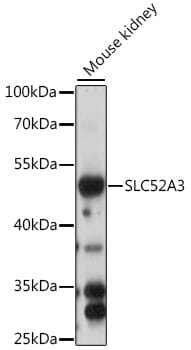 Western blot analysis of extracts of mouse kidney, using Anti-SLC52A3 Antibody (A15935) at 1:1,000 dilution.
Secondary antibody: Goat Anti-Rabbit IgG (H+L) (HRP) (AS014) at 1:10,000 dilution.
Lysates / proteins: 25µg per lane.
Blocking buffer: 3% non-fat dry milk in TBST.
Detection: ECL Basic Kit (RM00020).
Exposure time: 60s.