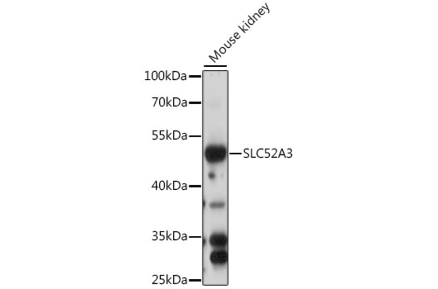 Western Blot - Anti-CT054 Antibody (A90298) - Antibodies.com