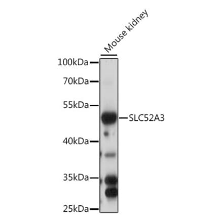 Western Blot - Anti-CT054 Antibody (A90298) - Antibodies.com