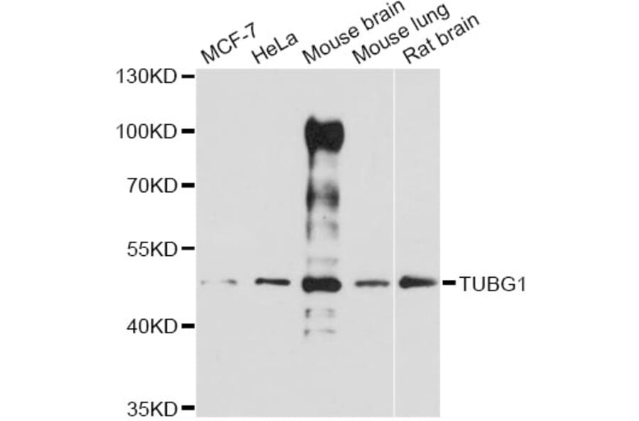 Western Blot - Anti-TUBG1 Antibody (A14554) - Antibodies.com