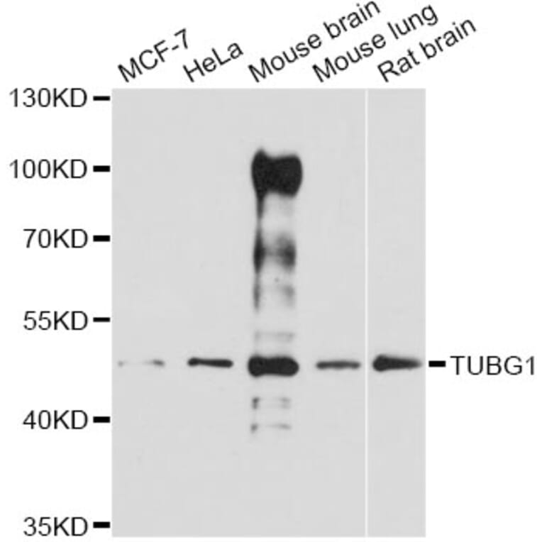 Western Blot - Anti-TUBG1 Antibody (A14554) - Antibodies.com