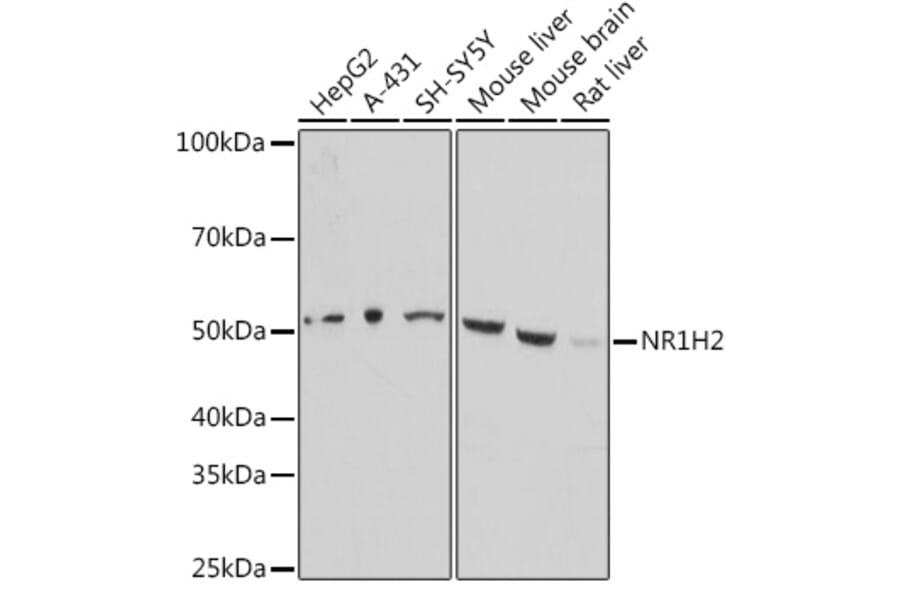 Western Blot - Anti-LXR beta/NER Antibody (A90300) - Antibodies.com