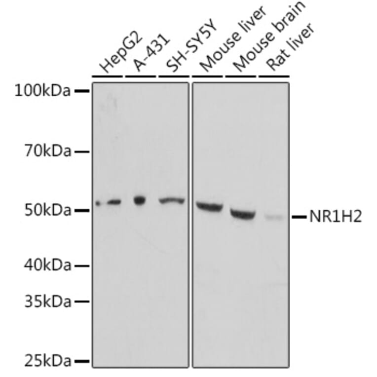 Western Blot - Anti-LXR beta/NER Antibody (A90300) - Antibodies.com